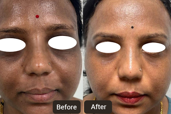 Skin Care Specialist in Chandigarh